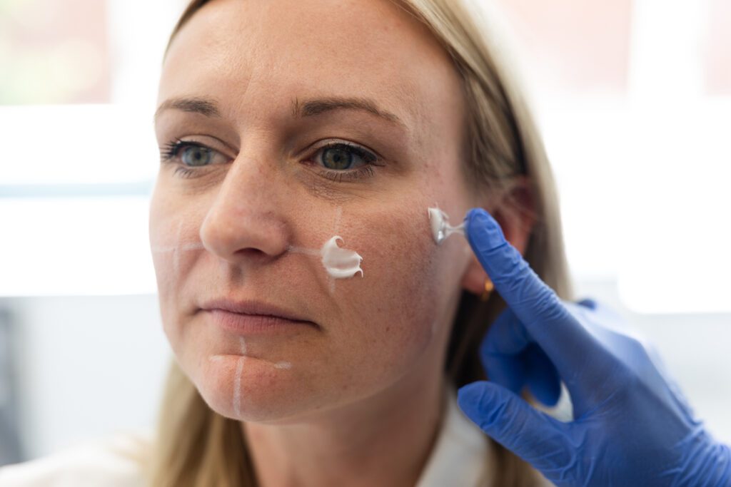 Female patient with numbing cream on their face